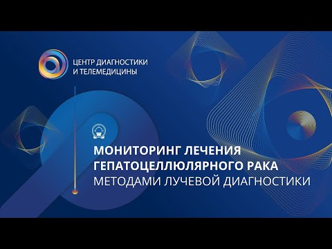 Мониторинг лечения гепатоцелюлярного рака методами лучевой диагностики