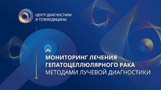 Мониторинг лечения гепатоцелюлярного рака методами лучевой диагностики