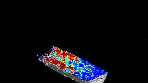 Vertical Flooding - 2D Slices from 3D FSE Images