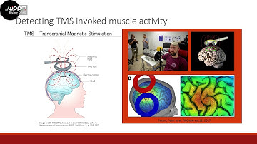 WOPM 2019 - 09 – Dr. Geoffrey Iwata – Biomagnetic signals recorded during TMS-invoked activity