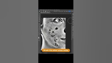 How to Remove Acne in Photoshop