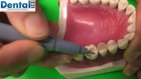 How to locate an Endo Orifice