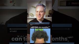 PATIENCE IS THE KEY! #hairlosshelp