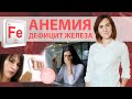 ЖЕЛЕЗОДЕФИЦИТНАЯ АНЕМИЯ | Дефицит железа в организме. Симптомы, анализы, советы врача.