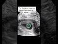So precious! Next week were finding out if its a girl or a... #Shorts #dr.katie.h