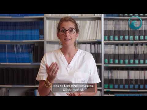 Camille JAUFFRET Dépistage cancers gynécologiques