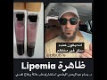 هل رأيت هذا المنظر من قبل ظاهرة Lipemia