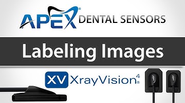 Apteryx XrayVision Labeling Images - Apex Dental Sensors - Training
