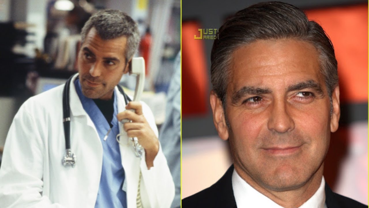 WHAT I THINK GEORGE CLOONEY DID TO REVERSE HIS HAIR LOSS!
