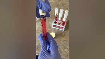 Biochemical Testing for Microbial Identification: Carbohydrate Fermentation Testing