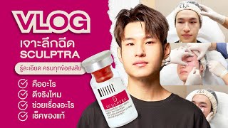 รีวิวเจาะลึกการฉีด Sculptra คืออะไร ดีไหม ช่วยเรื่องอะไร กับแพน Prepan ตอบครบทุกข้อสงสัย