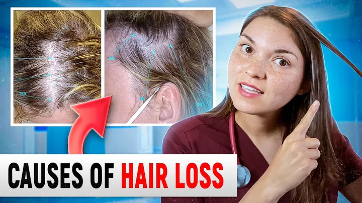 What HAIR LOSS Says About Your HEALTH: Top 15 Causes of Hair Loss (Doctor Explains)