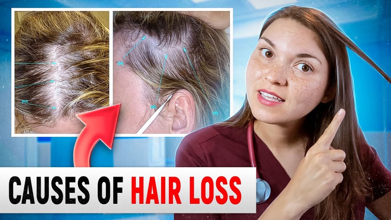 What HAIR LOSS Says About Your HEALTH Top 15 Causes of Hair Loss