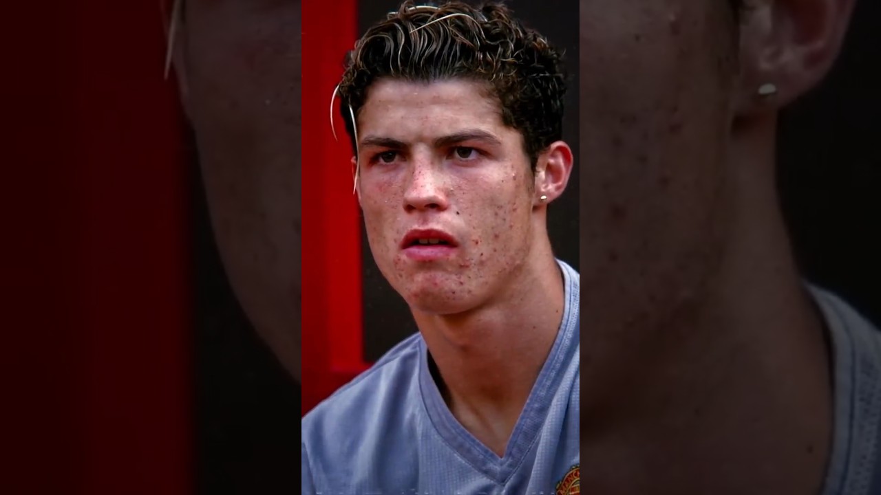 From Acne to Icon Cristiano Ronaldo’s $1 Million Glow Up! 😱💎