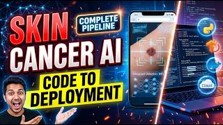 Complete Deep Learning Project: Skin Cancer Detection (Zero to Cloud)