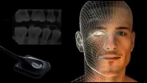 Vatech  EZ Sensor   Explanation Video