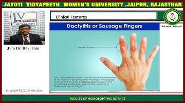 JAYOTI VIDYAPEETH - Locomotor System - Reactive Arthritis