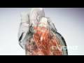 Glass heart hybrid medical animation