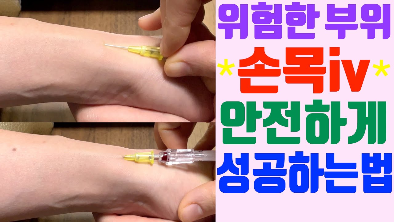 신경,통증때문에 피하게되는 손목부위 iv 실패없이 성공하는 비결 / 좋은 혈관인데도 실패하는 이유 / 손목iv 실제영상 / iv잘놓는법