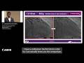 Activating AI for DA-Less procedures - A new chapter for interventional cardiology