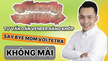 Cải Thiện Răng Móm Bằng Dán Sứ Veneer | Tìm Lại Nụ Cười Sau Bao Năm Tự Ti
