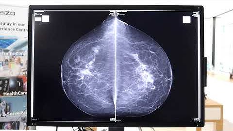 EIZO RadiForce RX1270 - The compact and convenient all-rounder in radiological diagnostics