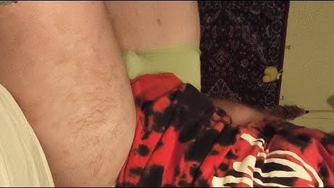 checking my sleep diagnos Dissociative disorder mixed