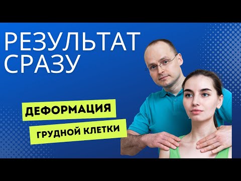 Воронкообразная грудная клетка. Лечение методом P-DTR: демонстрация и объяснение принципов работы
