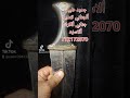 تعديل وتغيير ألجنابي ألكرك ألاسود ألذي لايتغير مع الوقت او أللبس ألان لدينا يتم تعديليها بشكل اجمل 