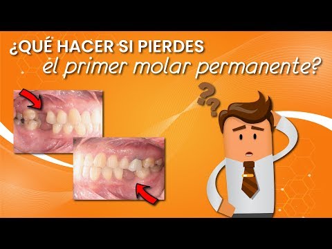 Video: ¿Pierdes las muelas de niño?