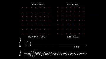 MRI: Physics and Image Creation - Spin Lattice Relaxation (Part 7/18)