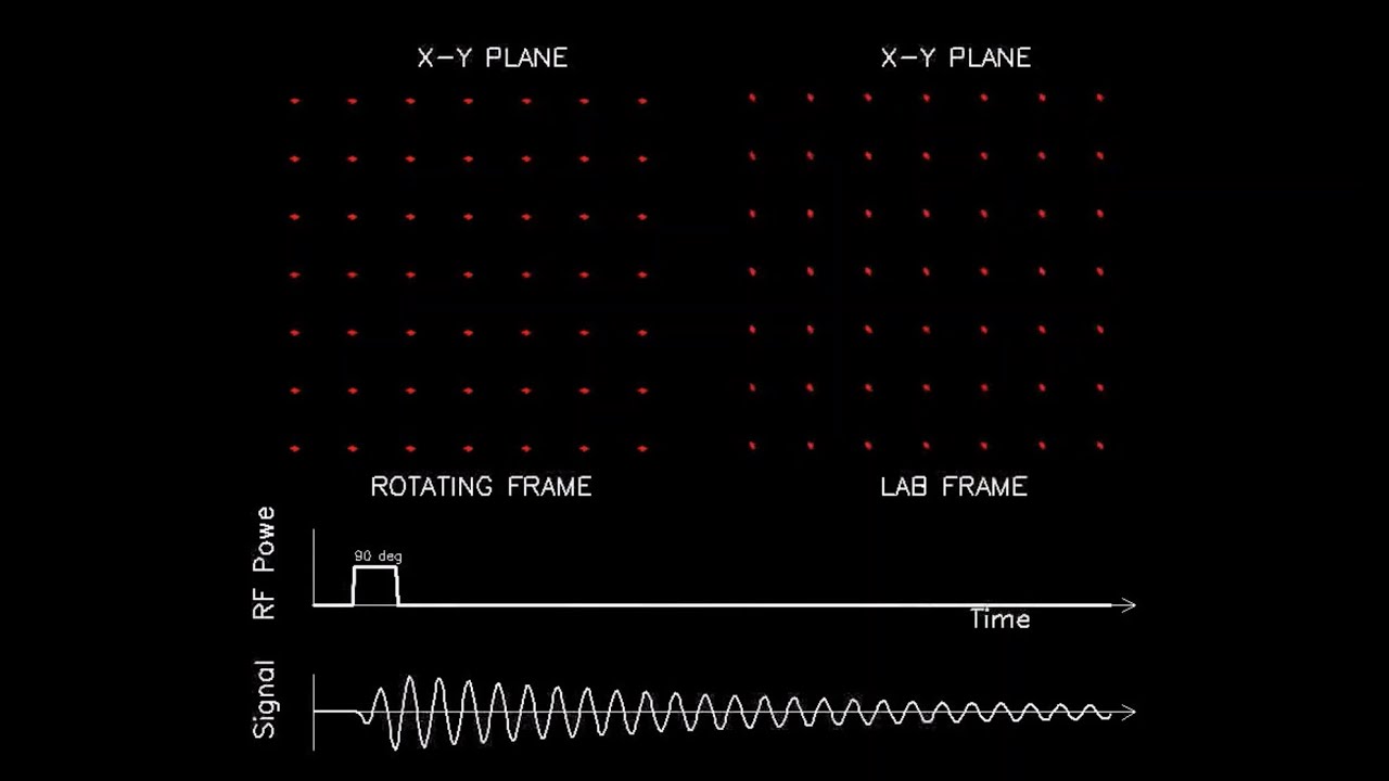 MRI Physics and Image Creation Spin Lattice Relaxation (Part 7/18) YouTube