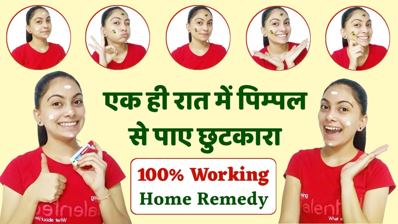 Pimple Free Skin Tips In Hindi Beauty & Health