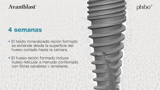 Proceso de osteointegración (Español)