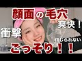 【閲覧注意】顔面全体に毛穴パック!汚すぎてショック。