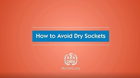 How To Avoid Dry Sockets