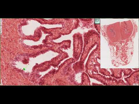 Histology of the Seminal Vesicles 4K