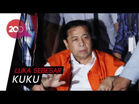 Video: Benjolan Di Dahi: Kemungkinan Penyebab Dan Kapan Mencari Bantuan Medis