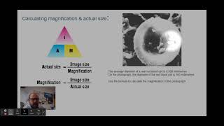 Biology 2 calculations involving magnification