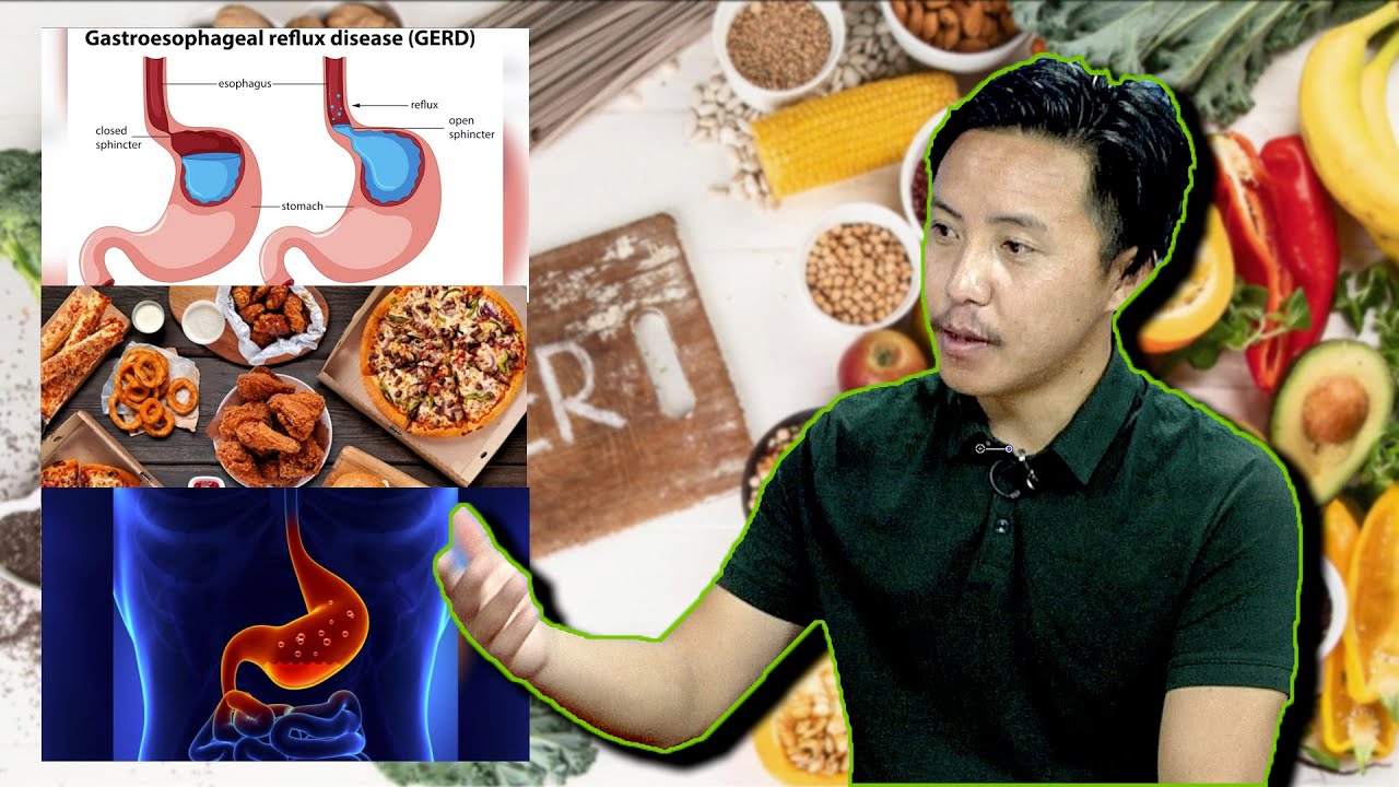 Gastritis, prevention and treatment ཕོ་བའི་ནད་ཀྱི་རྒྱུ་རྐྱེན་དང་གསོ་བཅོས།