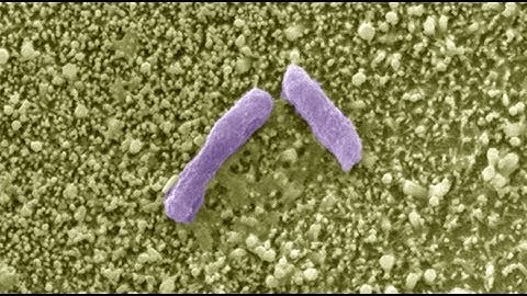 Novel Solid‐State Microbial Sensors Based on ZnO Nanorod Arrays