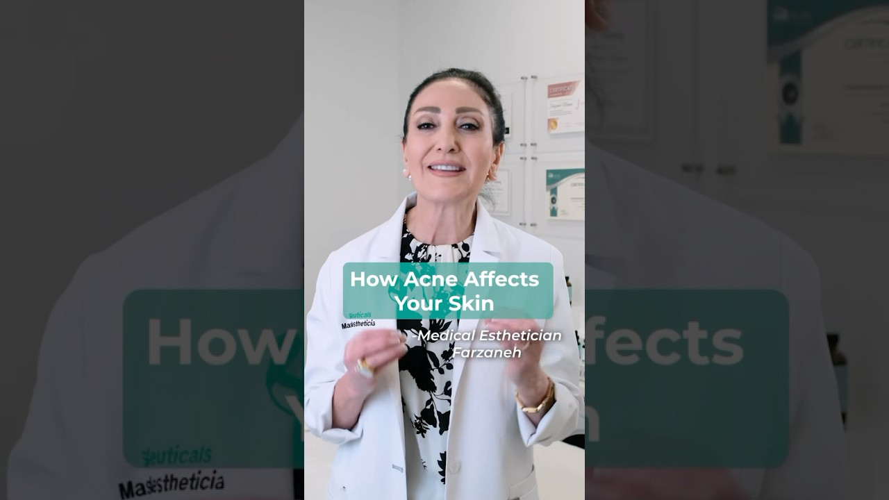 Banner for Acne 101: Causes, Treatments & What Actually Works