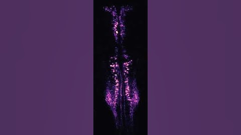 Activity in genetically-identified neurons of the hindbrain of zebrafish larva.