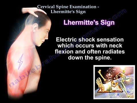 Cervical Spine Examination, Lhermitte&rsquo;s Sign - Everything You Need To Know - Dr. Nabil Ebraheim
