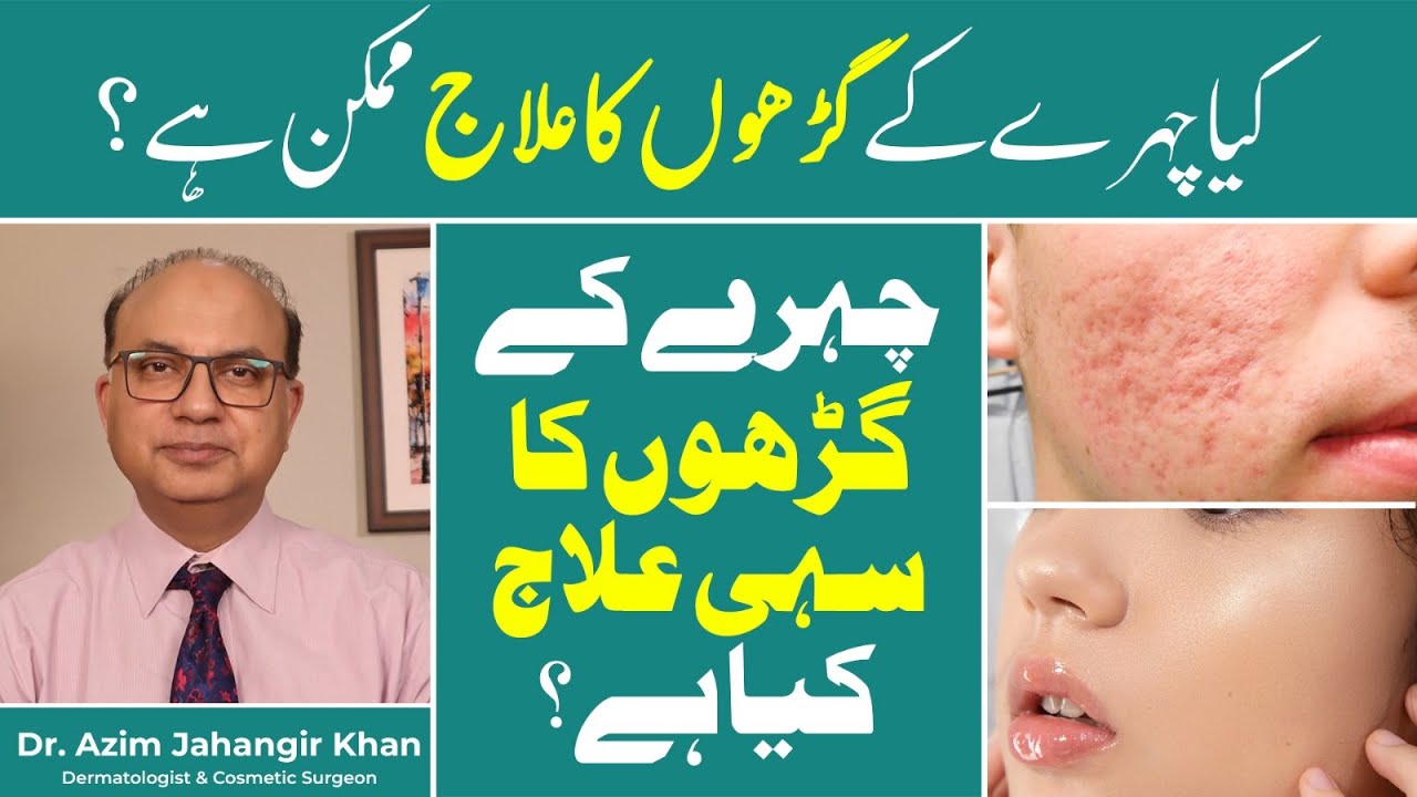 Latest Treatments for Acne Scars (Gharay) | Best Dermatologist Advice | Cosmetique