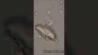 microscopic World #explorepage#microbiology#microscopevideo#microscopyworld #viralvideo #boost