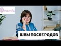 Швы после родов - Др. Елена Березовская