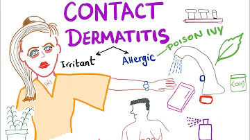 What is sensitization dermatitis?