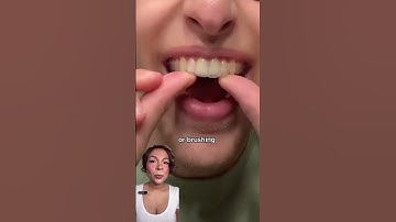 What to do with smelly retainer/aligner?