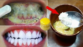 تبييض الأسنان تلميع الأسنان , في 1_دقيقة , وصفة تزيل الاصفرار وتخلصك من جير الأسنان , نتيجه فعاله